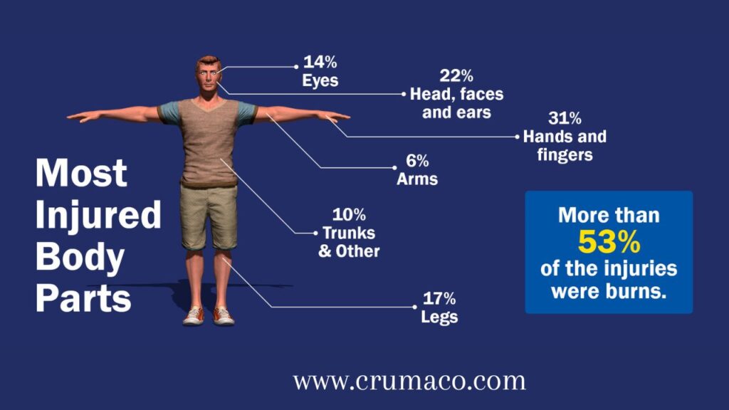 The Body part Are Most Commonly Injured